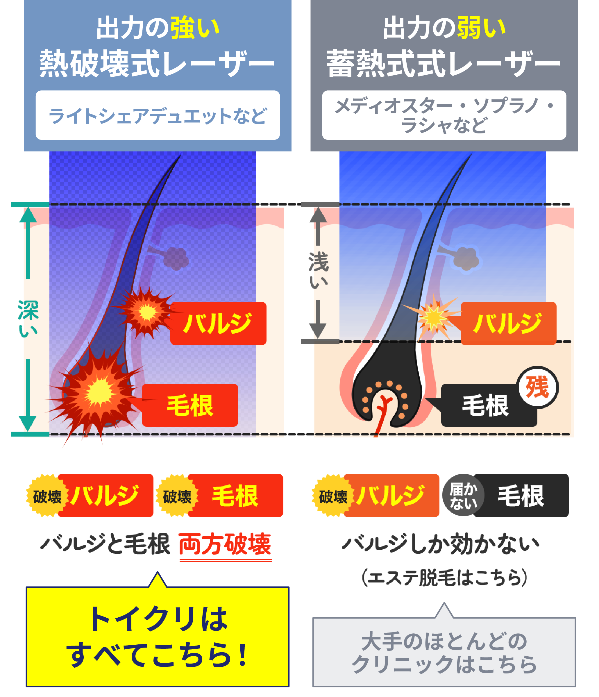 出力の強い熱破壊式レーザー 出力の弱い蓄熱式レーザー